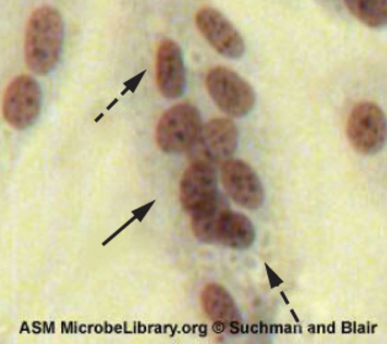 Paramyxovirus which causes syncytium and faint basophilic cytoplasmic inclusion bodies. Small structures are seen within a cell.