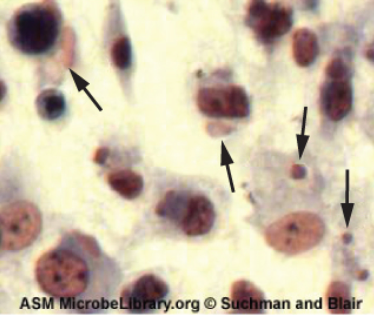 Poxyvirus results in pink eosinophilic cytoplasmic inclusion bodies (seen as small structures) and cell swelling.