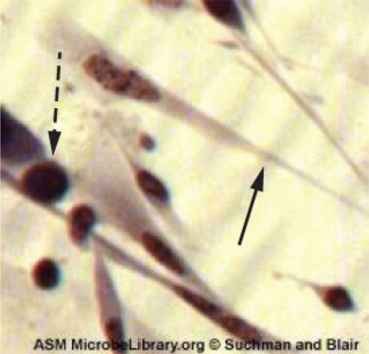 Herpesvirus causes cytoplasmic stranding (seen as an elongation of the cytoplasm) and nuclear inclusion bodies (seen as structures within the nucleus).