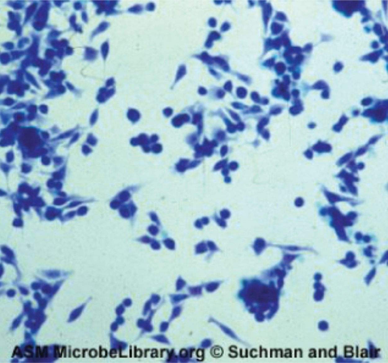 Adenovirus causes cell enlargement, rounding, and distinctive grape-like clusters.