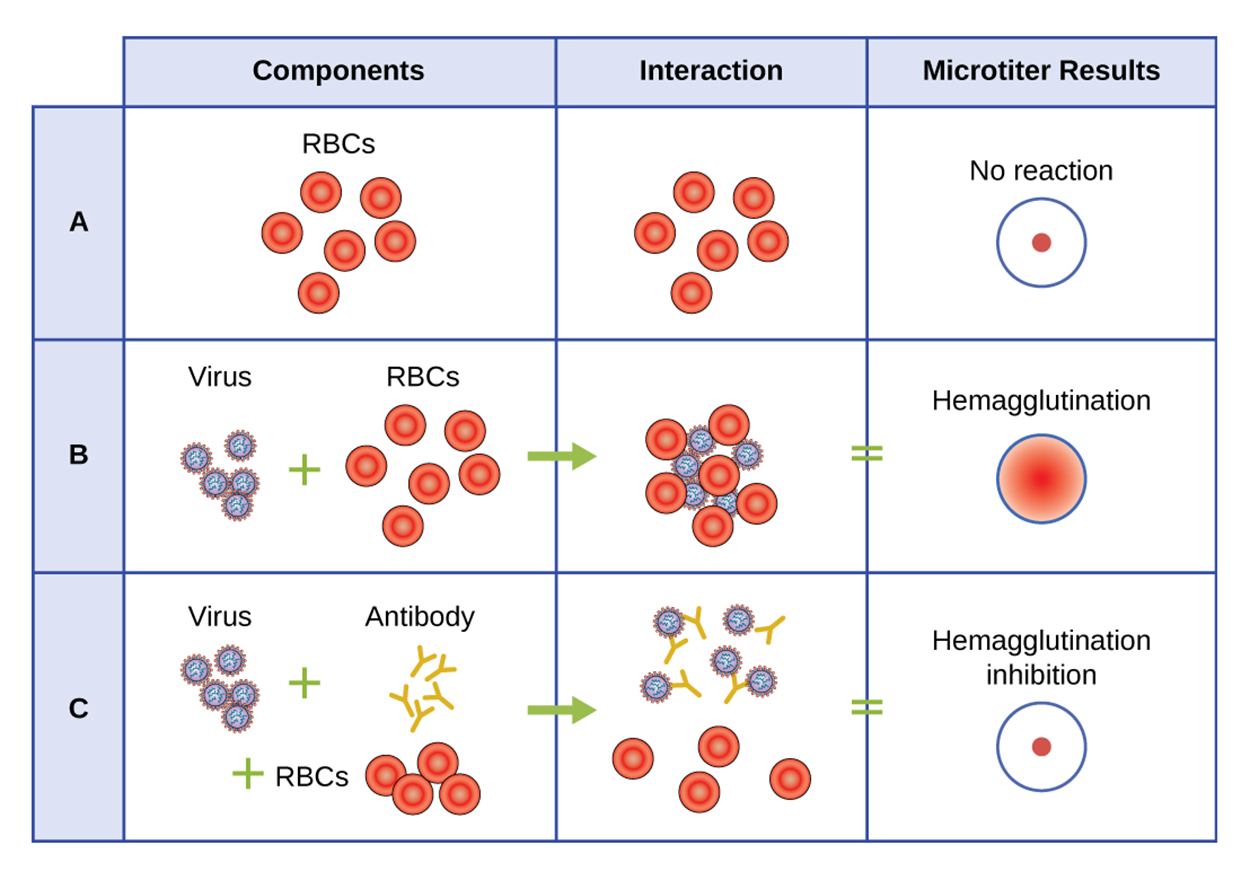 This chart has three columns labeled components, interactions, and mictotiter results. In row A the components are the red blood cells which do not interact with anything and show no reaction in a microtiter result. The lack of reaction is seen as a small red dot in the center of the well. In row B the components are viruses and red blood cells. The viruses and red blood cells clump together and this is seen in a microtiter resulting in redness throughout the well. This is called hemagglutination. In row C, the components are viruses, red blood cells, and antibodies. The viruses and antibodies clump together but the red blood cells do not clump with anything. This is again seen as no reaction; this is called hemagglutination inhibition.