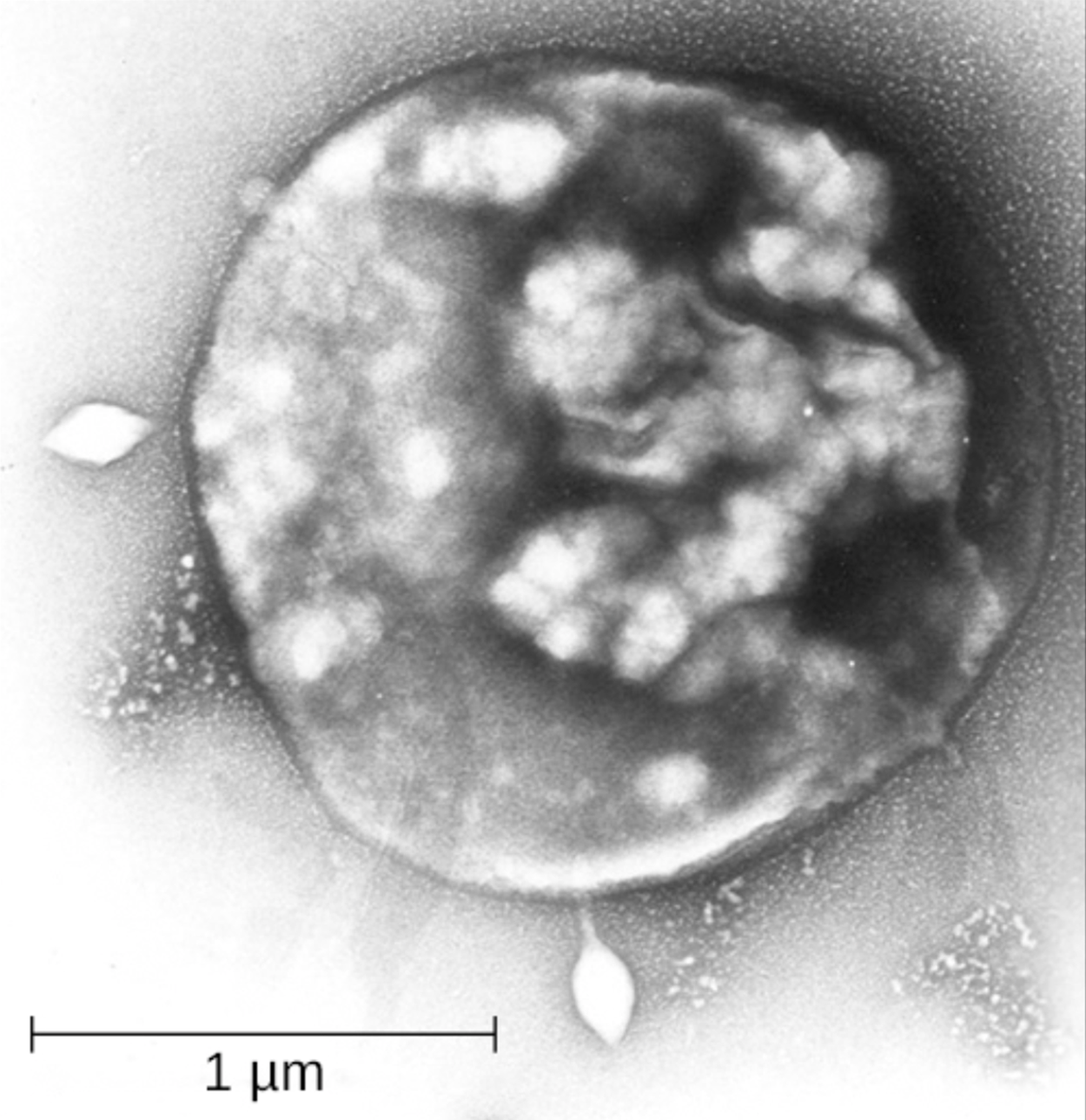 A micrograph of a spherical cell with diamond-shaped structures inside it.