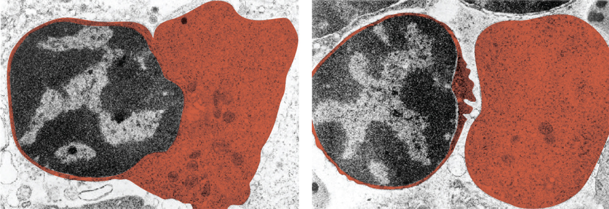 This set of micrographs shows a red blood cell extruding its nucleus. In the left panel, the nucleus is partially extruded from the red blood cell, and in the right panel, the nucleus is completely extruded from the cell.
