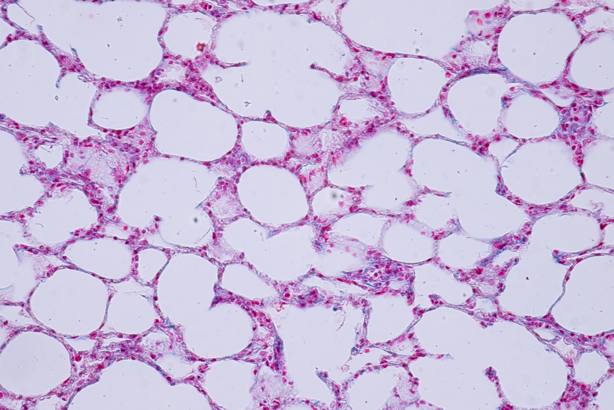 Micrograph of Simple Squamous Epithelium is shown. The cells are thin and curved to surround the air sacs of the lung.