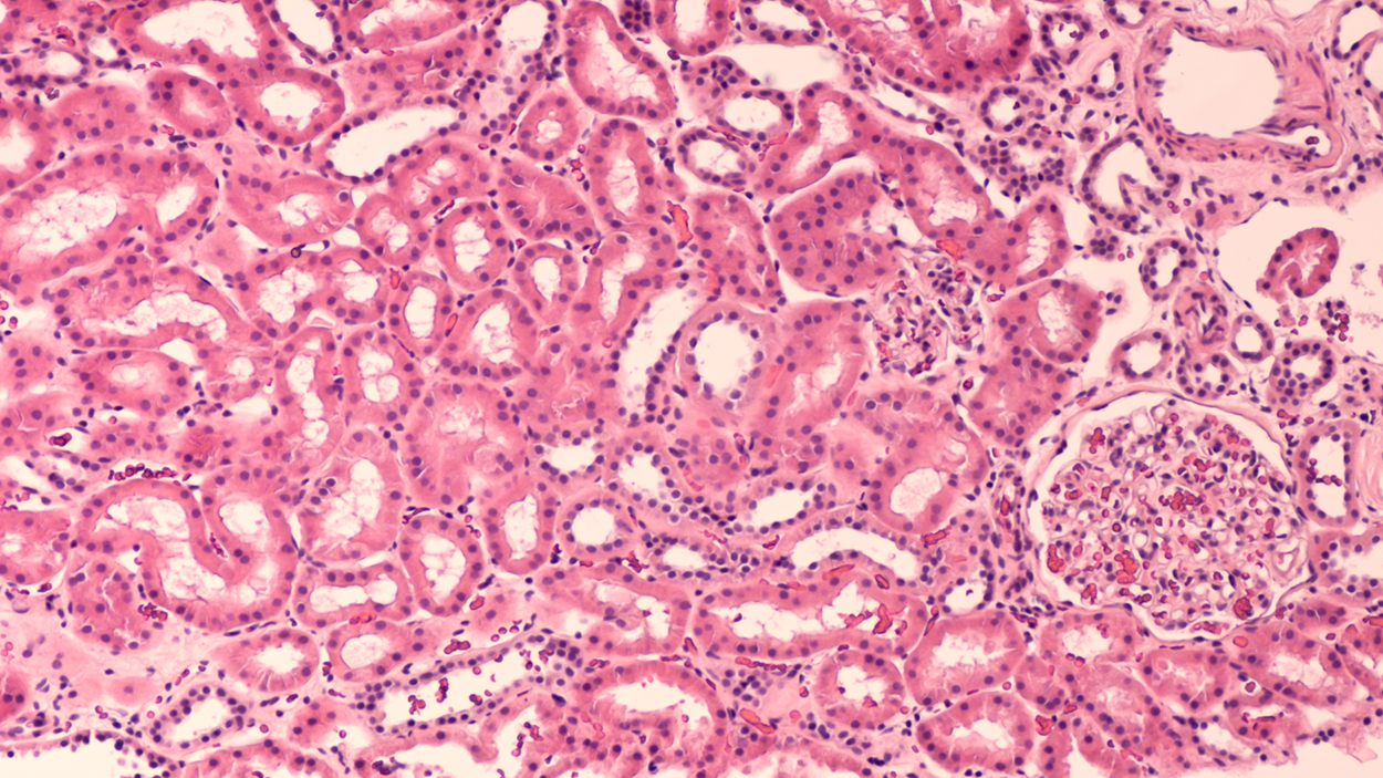 Image is a micrograph of Simple Cuboidal Epithelium. Cells surround open tubules, and cells are cube-shaped. The overall shape is similar to the curve of a stone arch made of roughly square stones.