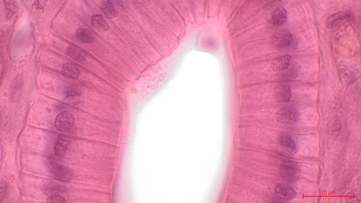 Image is a micrograph of Simple Columnar Epithelium. The cells are tall and skinny and arranged tightly together with their long sides adjacent.