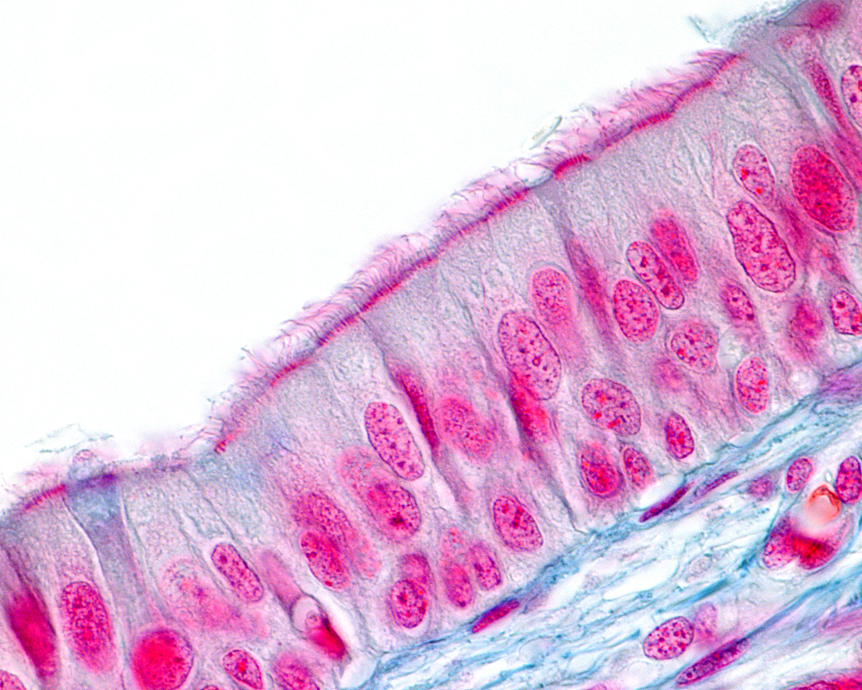 Image is a micrograph of Pseudostratified Columnar Epithelium. Cells are long and skinny, arranged tightly with long sides adjacent. The short end of the cells face the outside and are covered with many fine cilia.