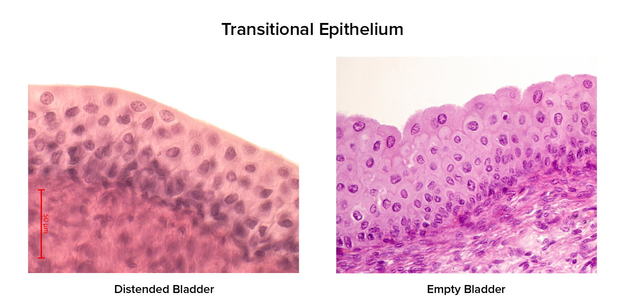 Micrograph of Transitional Epithelium in stretched and relaxed states. The empty bladder relaxed state image show cells with rounded or domed surfaces. The distended bladder image shows cells that are compressed and flat along the apical surface.