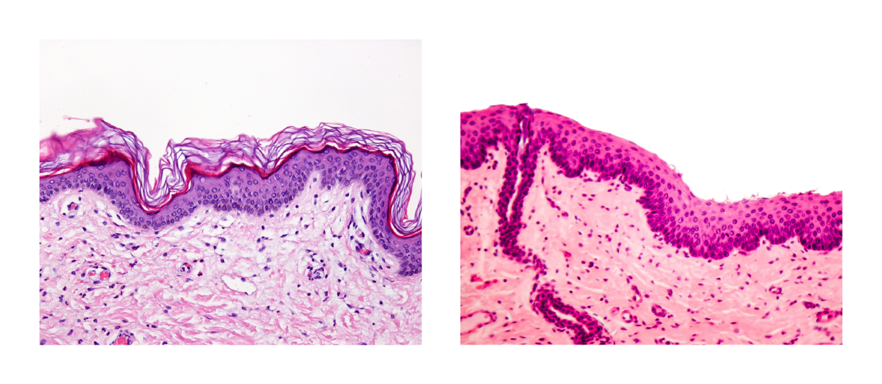 Two micrographs of Stratified Squamous Epithelium are shown. The image of skin shows long flat cells with lots of keratin fibers along the outer surface, and more cubed-shaped cells deeper. The mouth epithelium is similar but without the distinctive keratin layer on the apical surface.