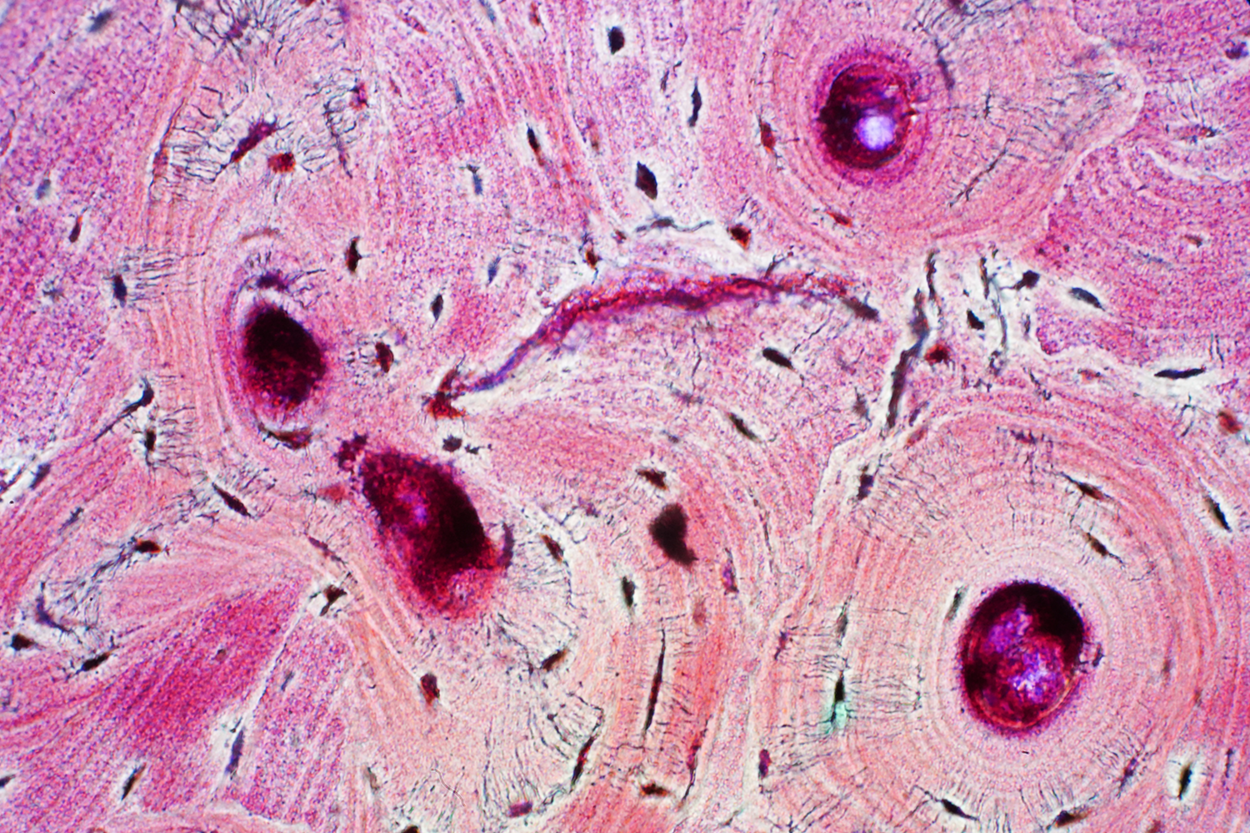 Connective Tissue: Supports and Protects Tutorial | Sophia Learning