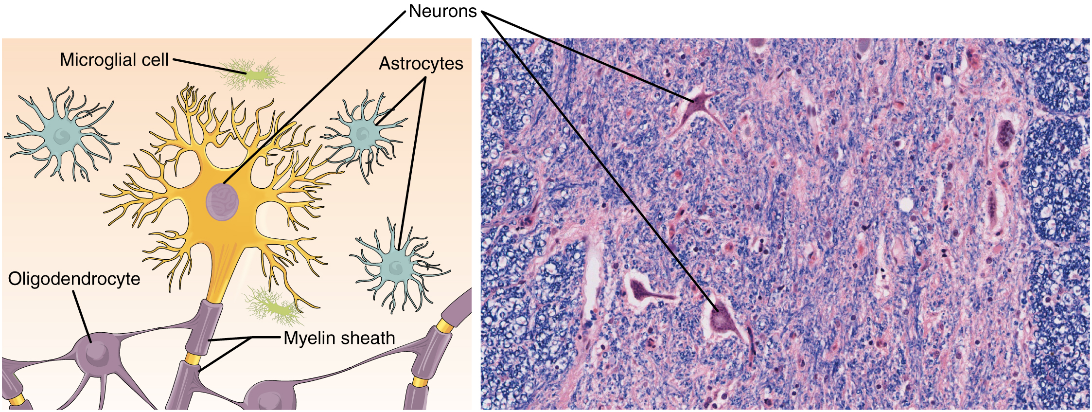 Nervous Tissue - Nervous tissue is made up of neurons and neuroglia. The cells of nervous tissue are specialized to transmit and receive impulses. Part A of this diagram shows various types of nerve cells. The largest cell is a neuron. The central body of the neuron contains a single nucleus. Six sets of dendrites project from the top, left and right, edges of the neuron. The dendrites are yellow and branch many times after leaving the cell, taking on the appearance of tiny trees. The axon projects from the bottom edge of the cell and is covered with purple sheaths labeled the myelin sheath. The sheath is not continuous, but instead is a series of equally spaced segments along the axon. Another cell, called an oligodendrocyte, is spider-like in appearance, with its leg-like projections each connecting to a segment of the neuron’s myelin sheath. Above the neuron are three astrocytes. They are much smaller than the neuron and have no axons and are also irregularly shaped cells with many dendrites projecting from the central body. Finally, a microglial cell is shown above the neuron. It is the smallest of the cells in this figure and is an elongated cell with many fine, tentacle-like projections. The projections are concentrated at the two ends of the cell, with the middle area lacking any projections. The micrograph of the neural tissue shows that this tissue is very heterogenous, with both large and small cells embedded in the matrix. Much of the space between the cells is occupied by threadlike nerve fibers.