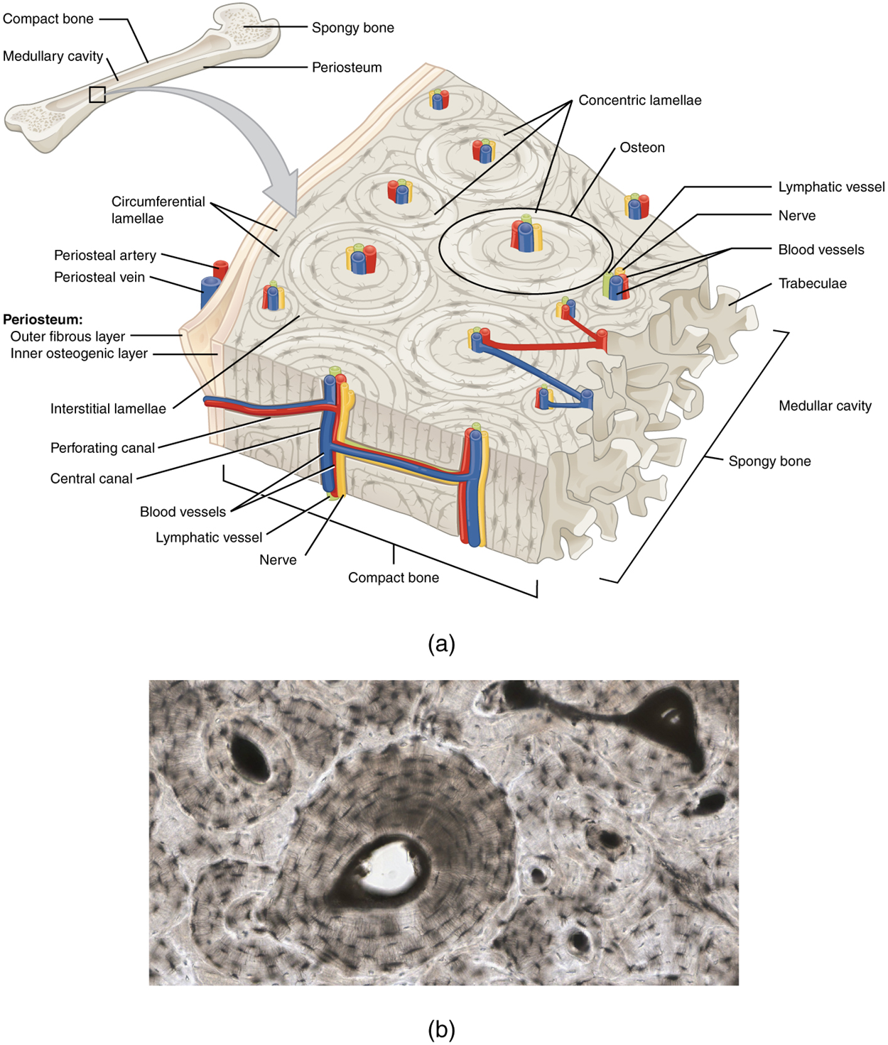 A generic long bone is shown at the top of this illustration. The bone is split in half lengthwise to show its internal anatomy. The outer gray covering of the bone is labeled the periosteum. Within the periosteum is a thin layer of compact bone. The compact bone surrounds a central cavity called the medullary cavity. The medullary cavity is filled with spongy bone at the two epiphyses. A callout box shows that the main image is zooming in on the compact bone on the left side of the bone. On the main image, the periosteum is peeled back to show its two layers. The outer layer of the periosteum is the outer fibrous layer. This layer has a periosteal artery and a periosteal vein running along its outside edge. The inner layer of the periosteum is labeled the inner osteogenic layer. The compact bone lies to the right of the periosteum and occupies the majority of the main image. Two flat layers of compact bone line the inner surface of the ostegenic periosteum. These sheets of compact bone are called the circumferential lamellae. The majority of the compact bone has lamellae running perpendicular to that of the circumferential lamellae. These concentric lamellae are arranged in a series of concentric tubes. There are small cavities between the layers of concentric lamellae called lacunae. The centermost concentric lamella surrounds a hollow central canal. A blue vein, a red artery, a yellow nerve, and a green lymph vessel run vertically through the central canal. A set of concentric lamellae, its associated lacunae, and the vessels and nerves of the central canal are collectively called an osteon. The front edge of the diagram shows a longitudinal cross-section of one of the osteons. The vessels and nerves are visible running through the center of the osteon throughout its length. In addition, blood vessels can run from the periosteum through the sides of the osteons and connect with the vessels of the central canal. The blood vessels travel through the sides of the osteons via a perforating canal. The open areas between neighboring osteons are also filled with compact bone. This “filler” bone is referred to as the interstitial lamellae. At the far right of the compact bone, the edge of the spongy bone is visible. The spongy bone is a series of crisscrossing bony arches called trabeculae. There are many open spaces between the trabeculae, giving the spongy bone its sponge-like appearance.