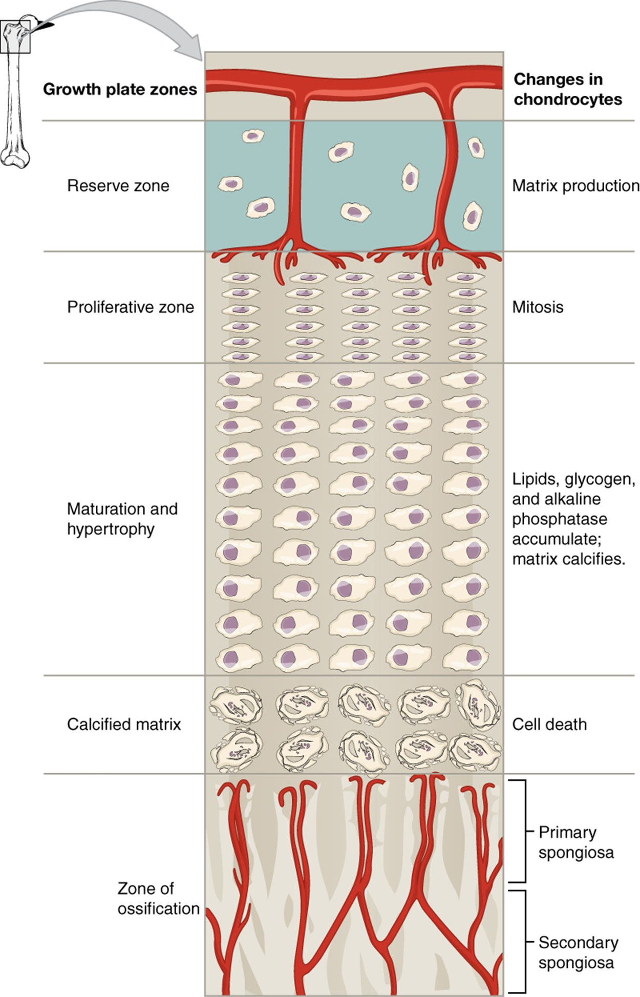 This illustration shows the zones bordering the epiphyseal plate of the epiphysis. The topmost layer of the epiphysis is the reserve zone, which is colored blue because it is made of cartilage. Two arteries are shown traveling through this zone to supply nutrients to the second zone: the proliferative zone. Here, five chondrocytes are undergoing mitosis. They continually divide, producing five long rows of chondrocytes. The next zone is the zone of maturation and hypertrophy. Here, lipids, glycogen, and alkaline phosphatase accumulate, causing the cartilaginous matrix to calcify. This zone consists of five rows of ten chondrocytes, which are increasing in size as one moves down a row. The next zone is the calcified matrix. Here, the chondrocytes have hardened and died as the matrix around them has calcified. The bottommost row is the zone of ossification. This zone is actually part of the metaphysis. Arteries from the metaphysis branch through the newly-formed trabeculae in this zone. The newly deposited bone tissue at the top of the zone of ossification is called the primary spongiosa. The older bone at the bottom of the zone of ossification is labeled the secondary spongiosa.