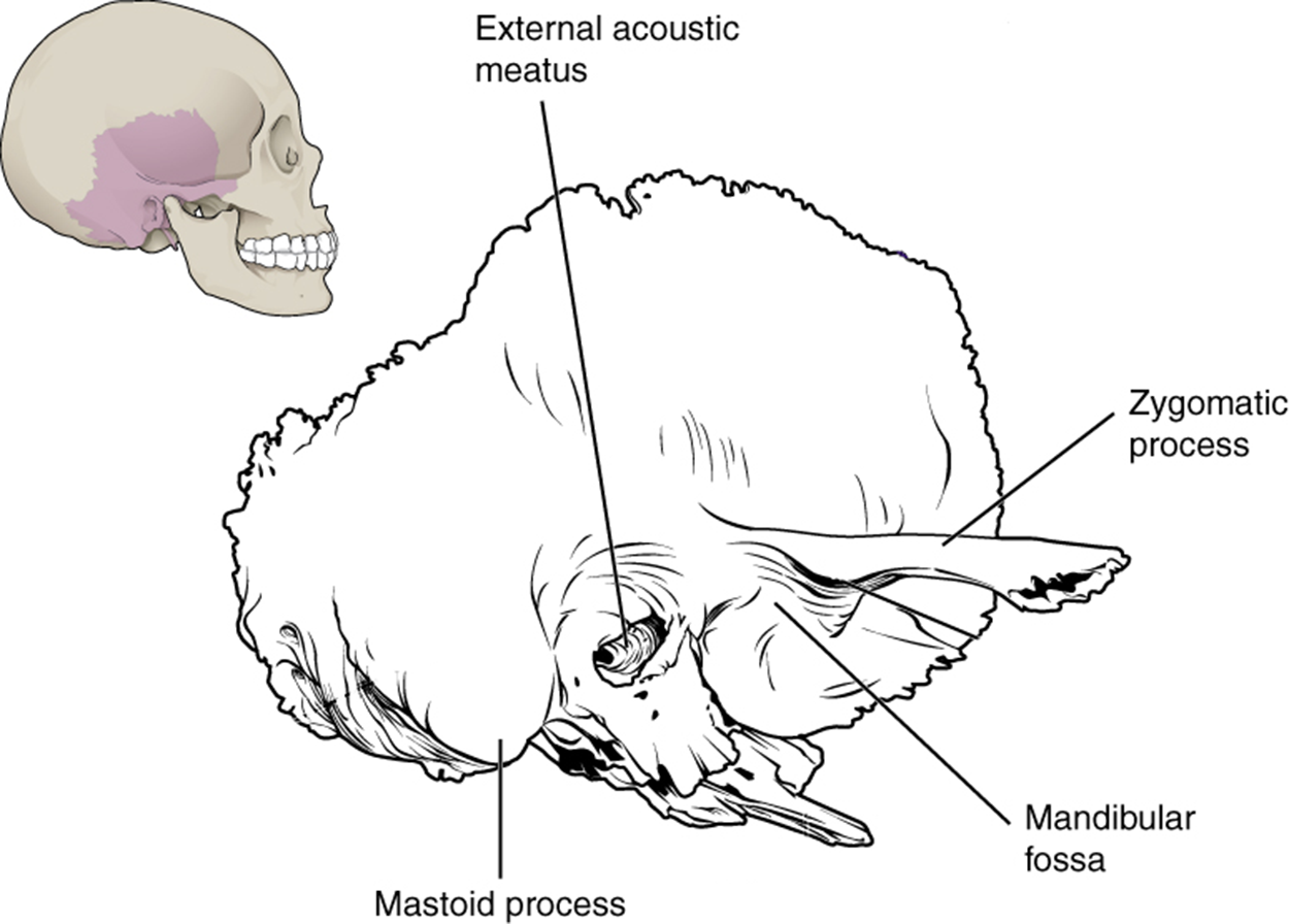 This image shows the location of the temporal bone. A small image of the skull on the top left shows the temporal bone highlighted in pink and a magnified view of this region then highlights the important parts of the temporal bone.