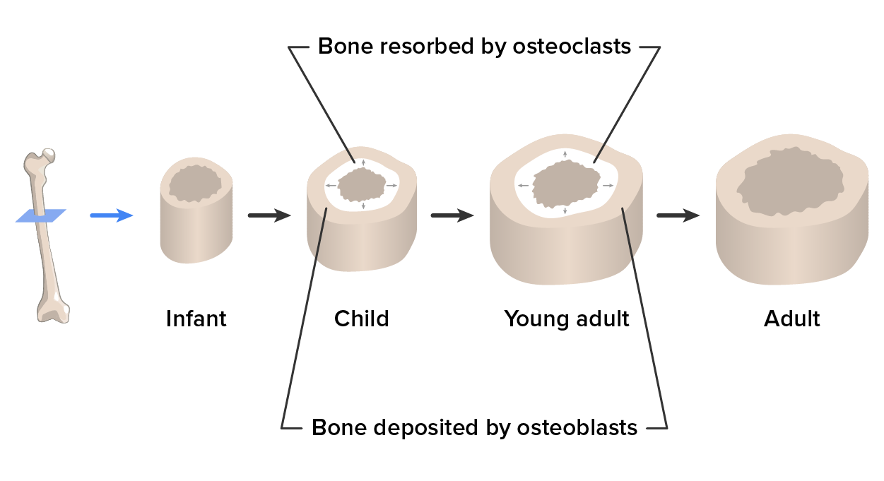 Diagram shows cross-sections of the femur bone from infancy, child, young adult, and adulthood. The bone increases in diameter by depositing new bone at the perimeter by osteoblasts, while old bone is removed from the inner diameter by osteoclasts. The adult bone shows no net osteoclast/osteoblast activity.