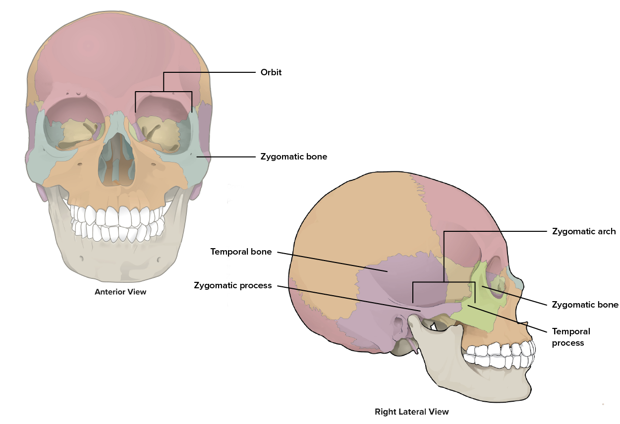 Image shows the location of the Zygomatic Bone in relation to the other bones of the face and skull.