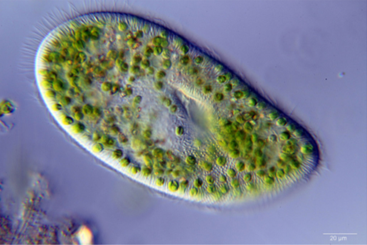 image of a Paramecium under a microscope. A paramecium is a microscopic eukaryotic, unicellular organism with cilia (hairlike structures for movement). Found predominantly in aquatic environments.