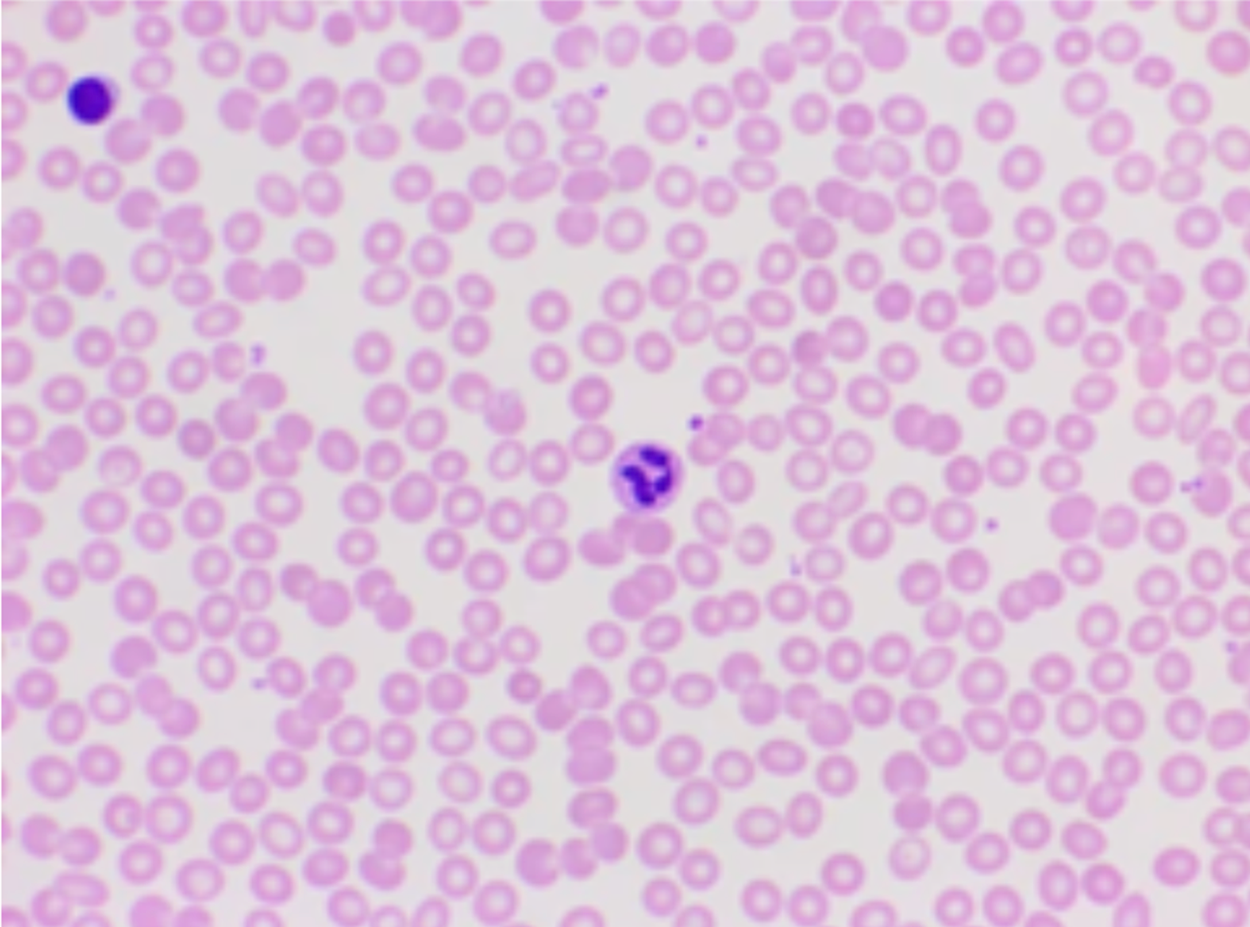Red and white blood cells viewed with Brightfield Compound microscope.