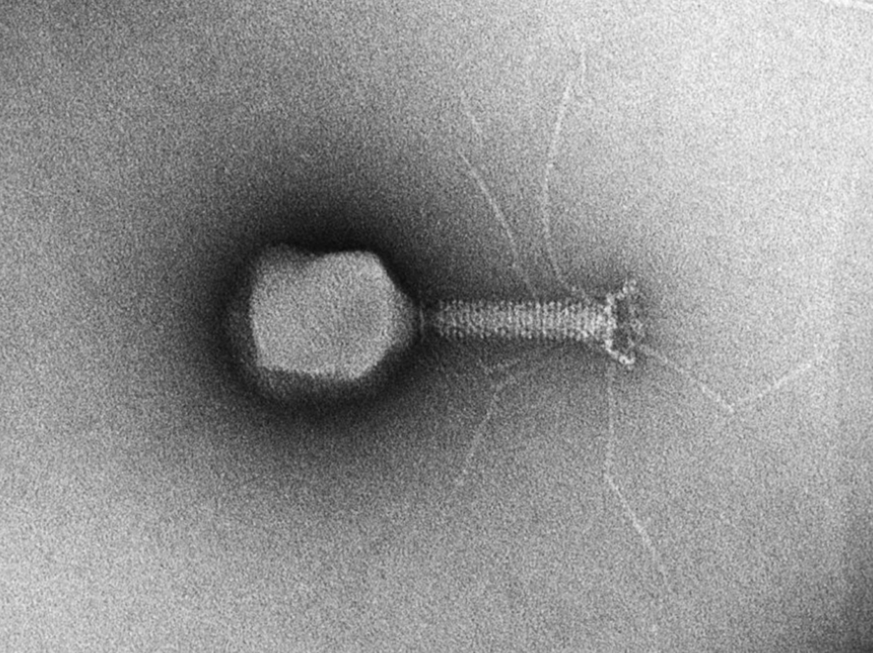 T4 Bacteriophage viewed with Transmission Electron Microscope