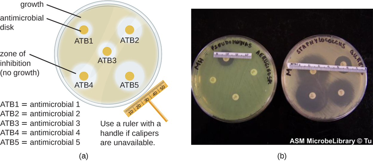 Bacterial Ruler Effectiveness of Chemical Control Agents Tutorial | Sophia Learning