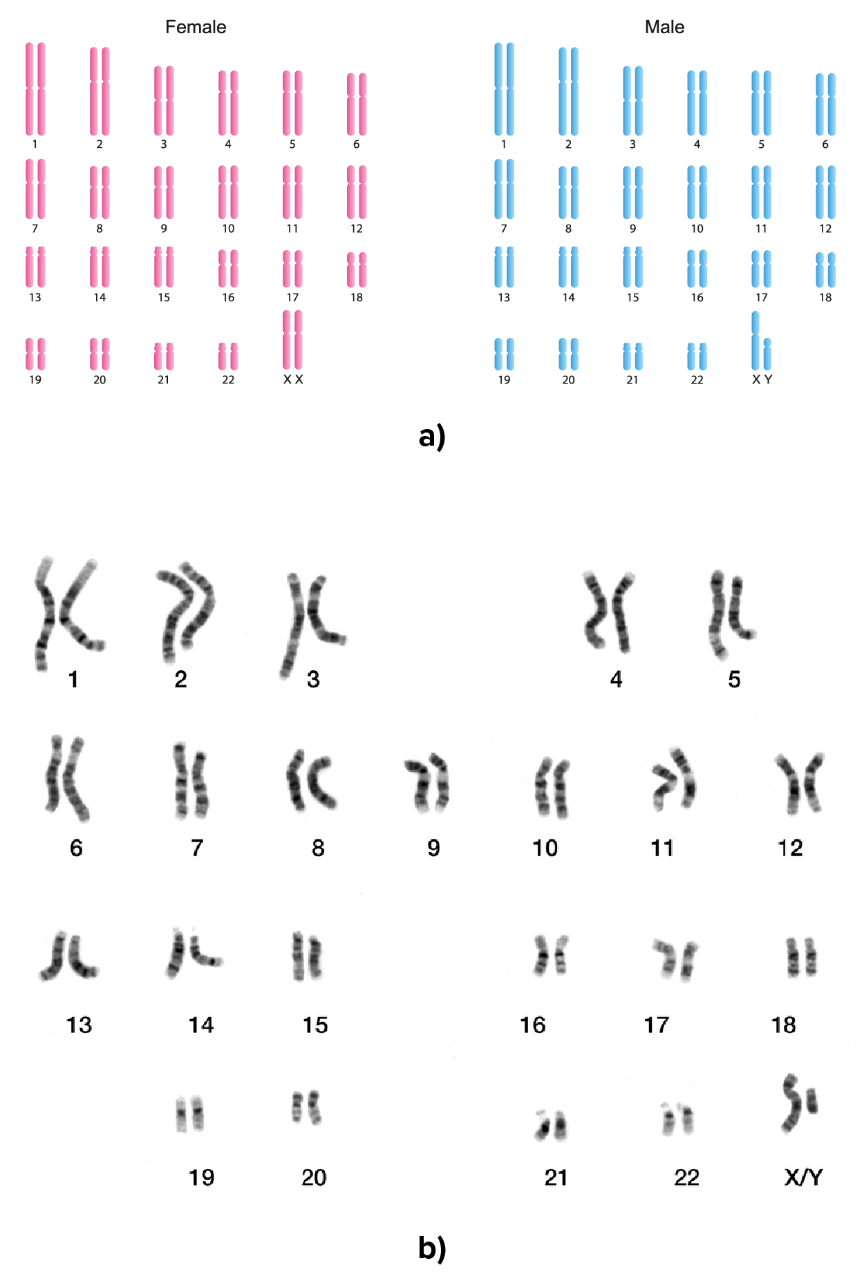 Part (a) shows two sets of chromosomes. The left-hand set is labeled female and the right-hand set is labeled male. Each set consists of twenty three pairs of chromosomes arranged roughly from largest pair to smallest pair. Each pair is numbered, ranging from 1 to 22, except for the last pair. In the female karyotype, the final pair consists of two relatively long chromosomes labeled as XX. In the male karyotype, the final pair consists of one relatively long chromosome labeled X and a much shorter chromosome labeled Y. Part (b) shows a micrograph of a male karyotype consisting of stained chromosomes. The chromosomes vary by having darker and lighter regions. Some of the chromosomes are somewhat curved. The final pair of chromosomes is labeled X/Y and shows a large X chromosome next to a small Y chromosome.