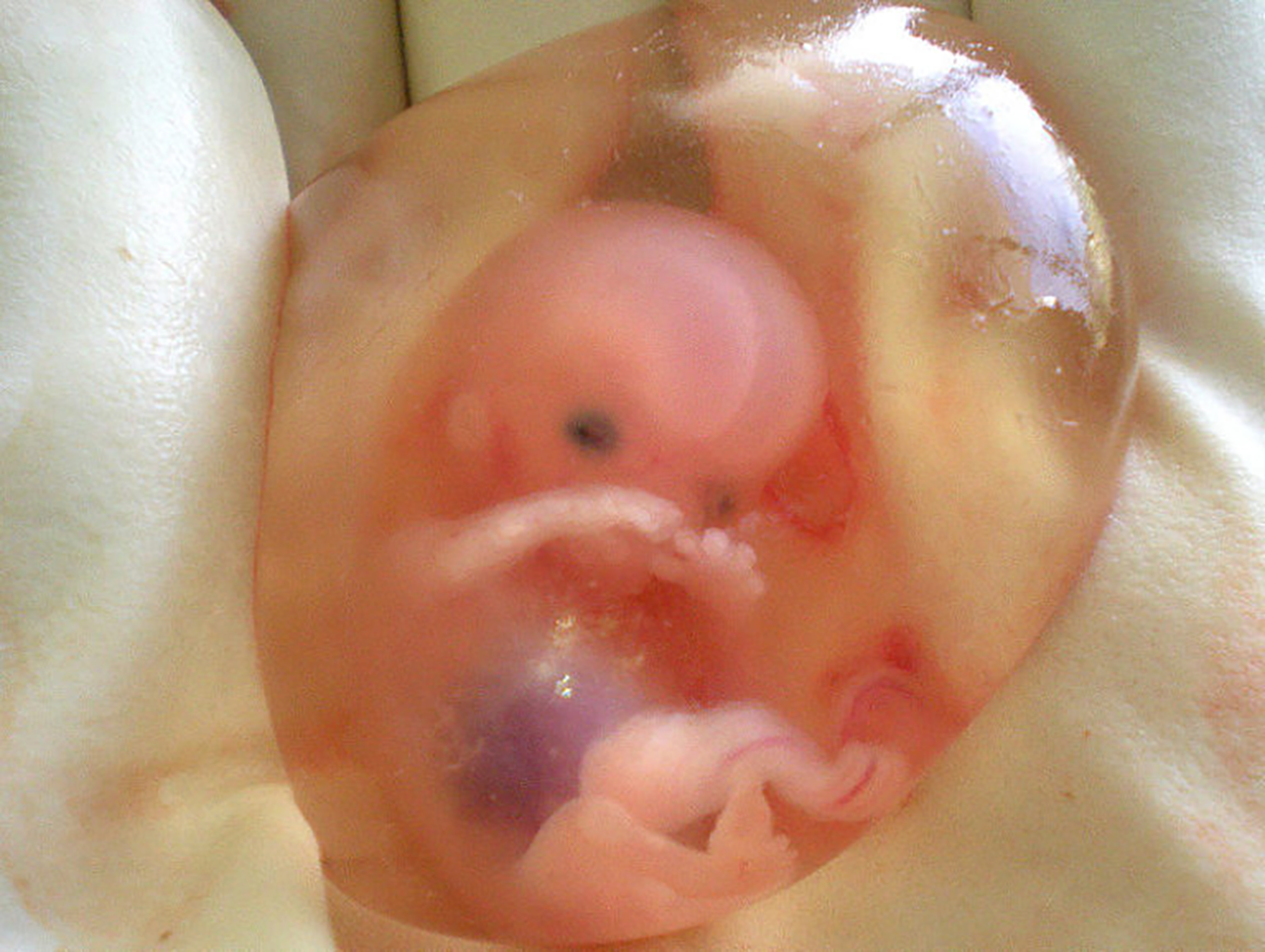 Image of a fetus at 10 weeks of development.