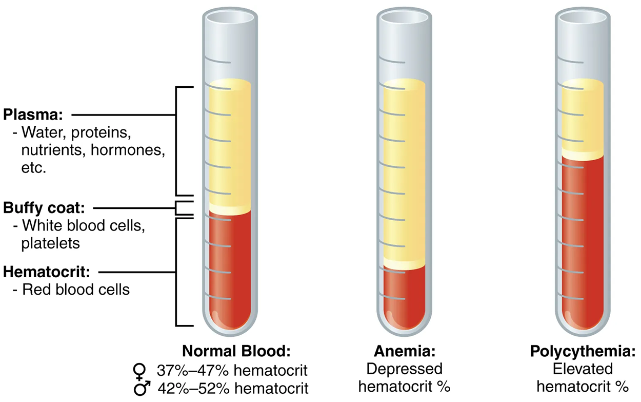 This figure shows three test tubes with a red and yellow liquid in them. The left panel shows normal blood, the center panel shows anemic blood, and the right panel shows polycythemic blood.