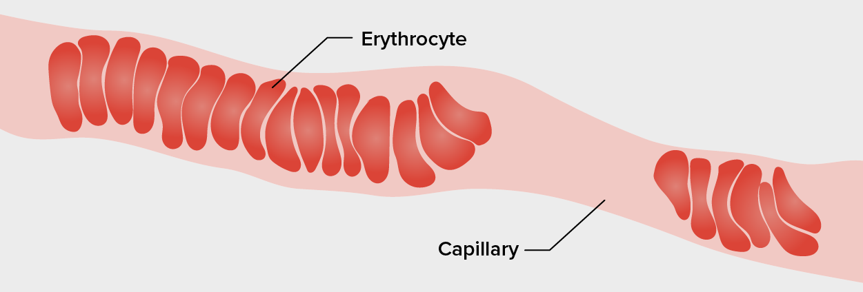 Erythrocytes stacked in a blood vessel.