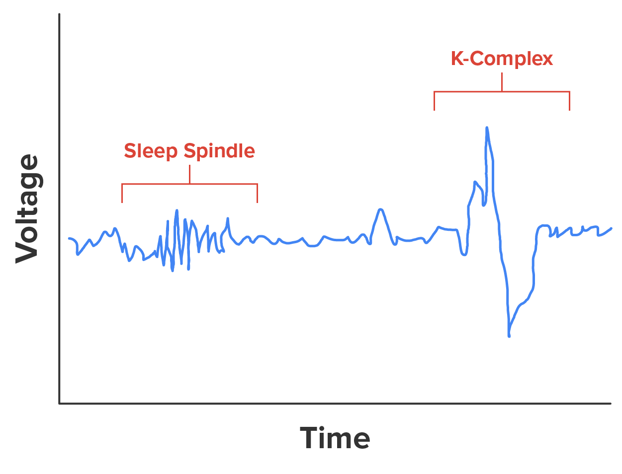 EEG output showing an example of a sleep spindle and a K-complex. The sleep spindle shows as a more rapid, high-frequency set of multiple waveforms. The K-complex shows as a large, sharp upward and then downward peaked waveform.