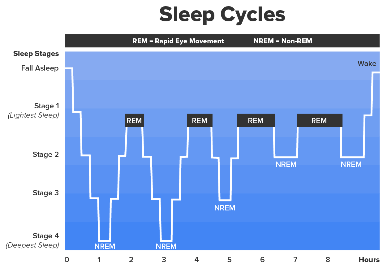 An example of five sleep cycles depicted on a graph. The X-axis is in hours, and the Y-axis has stage 4, or the deepest sleep, at 0, preceded by stage 3, stage 2, stage 1, and fall asleep. The cycles descend from lightest sleep to deepest sleep in a stepwise manner, and the graph depicts a longer time spent in REM with each sleep cycle until awakening.