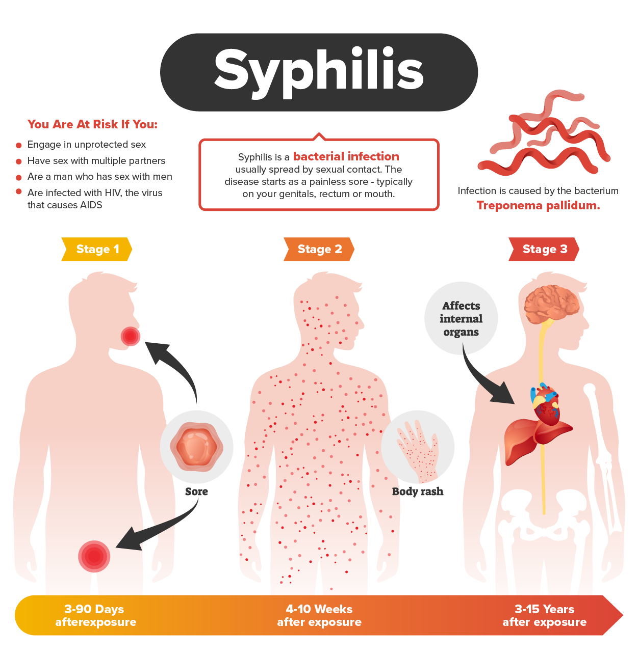 Syphilis Infected Map Sexually Transmitted Infections Tutorial | Sophia Learning