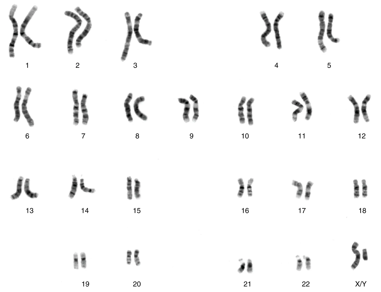 Chromosomal Complement of a Male - Each pair of chromosomes contains hundreds to thousands of genes. The banding patterns are nearly identical for the two chromosomes within each pair, indicating the same organization of genes. As is visible in this karyotype, the only exception to this is the XY sex chromosome pair in males. (credit: National Human Genome Research Institute) This figure shows the 23 pairs of chromosomes in a male human being.