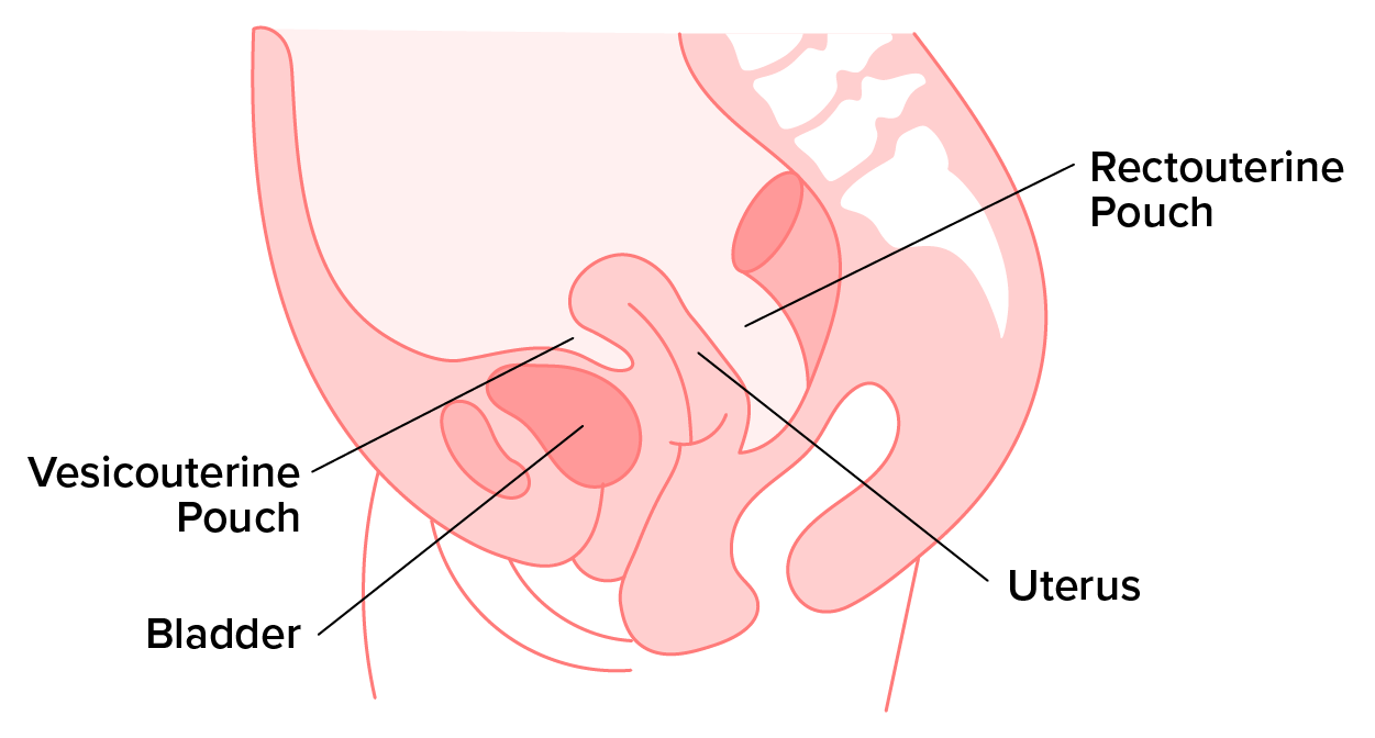Illustration shows the location of both the rectouterine pouch and the vesicouterine pouch.