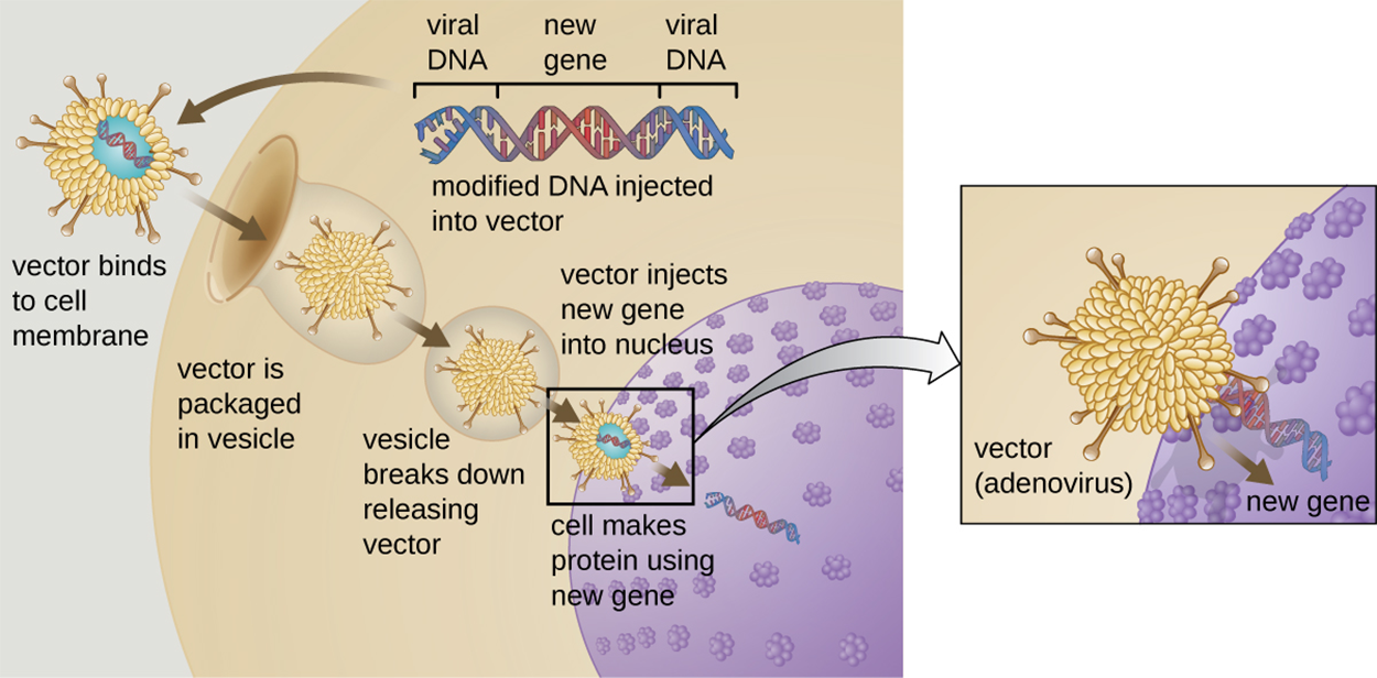 A diagram of gene therapy. A virus vector contains modified viral DNA that includes an inserted gene. First, the vector binds to the cell membrane. The vector is then packaged in a vesicle. The vesicle then breaks down releasing the vector. The cell now makes protein using the new gene.