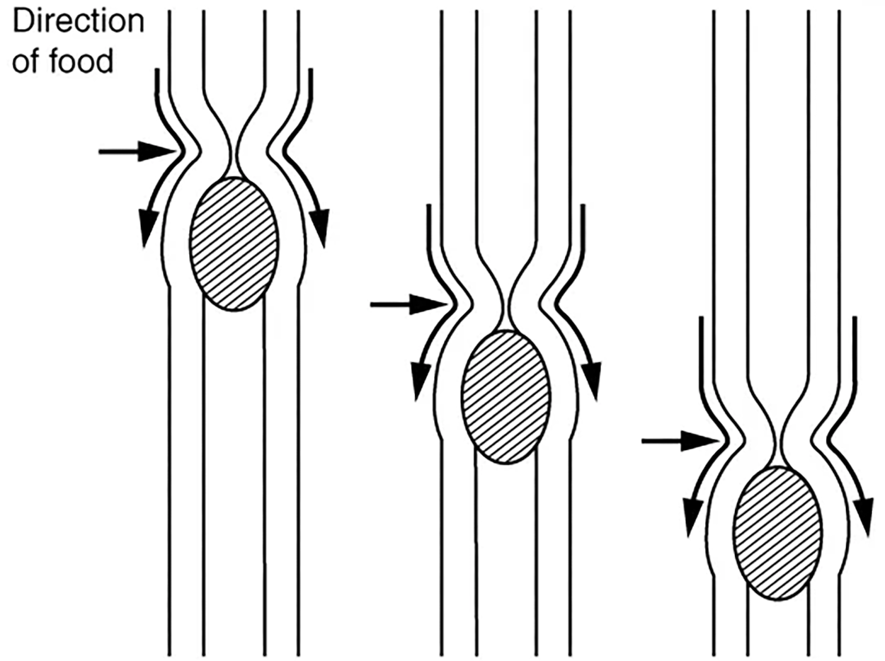 Peristalsis—Peristalsis moves food through the digestive tract with alternating waves of muscle contraction and relaxation.