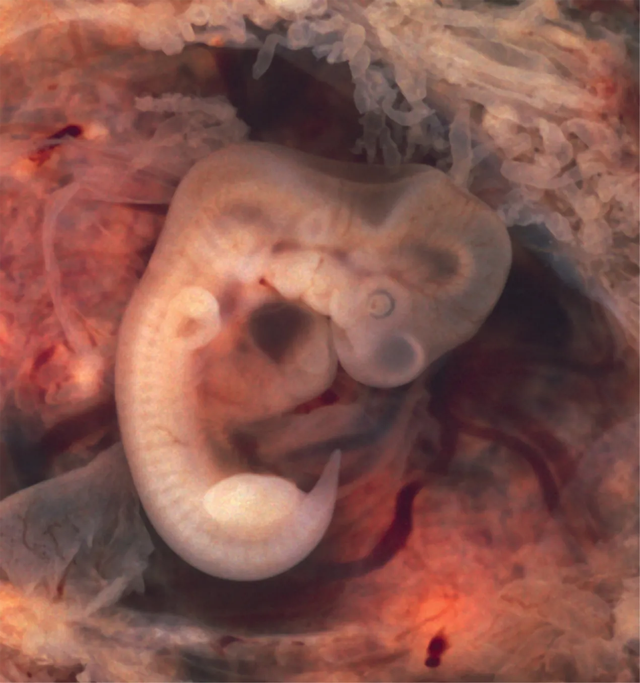 Embryo at 7 Weeks—An embryo at the end of 7 weeks of development is only 10 mm in length, but its developing eyes, limb buds, and tail are already visible. (This embryo was derived from an ectopic pregnancy.) (credit: Ed Uthman)