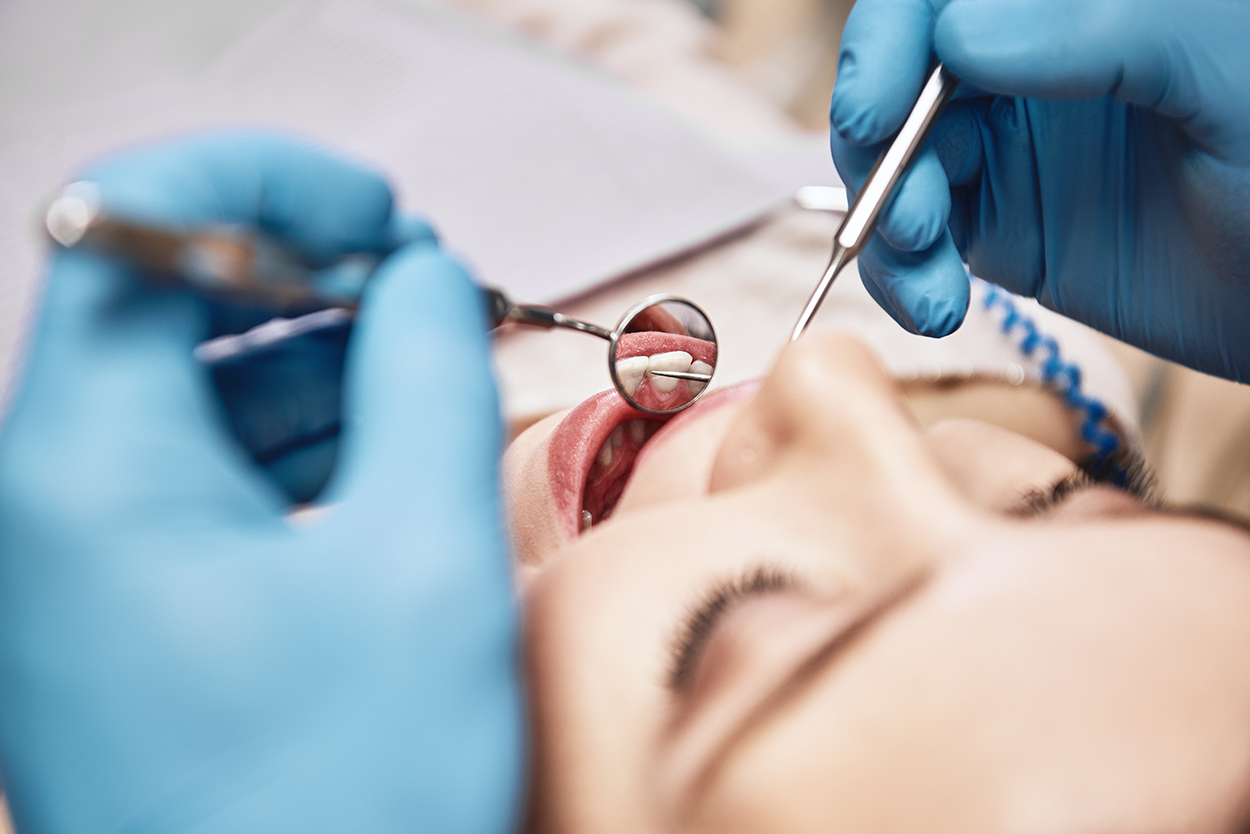 The image captures a close-up of a dental examination. A patient is lying back with their mouth open while a dentist, wearing gloves, uses a dental mirror and probe to inspect the teeth. The reflection in the mirror clearly shows part of the patient’s teeth and gums. The background is blurred, focusing attention on the procedure. The image conveys a routine dental checkup, emphasizing oral health and professional care.