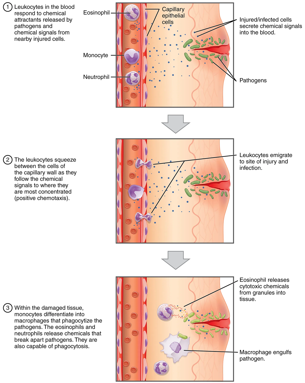 Emigration—Leukocytes exit the blood vessel and then move through the connective tissue of the dermis toward the site of a wound. Some leukocytes, such as the eosinophil and neutrophil, are characterized as granular leukocytes. They release chemicals from their granules that destroy pathogens; they are also capable of phagocytosis. The monocyte, an agranular leukocyte, differentiates into a macrophage that then phagocytizes the pathogens.