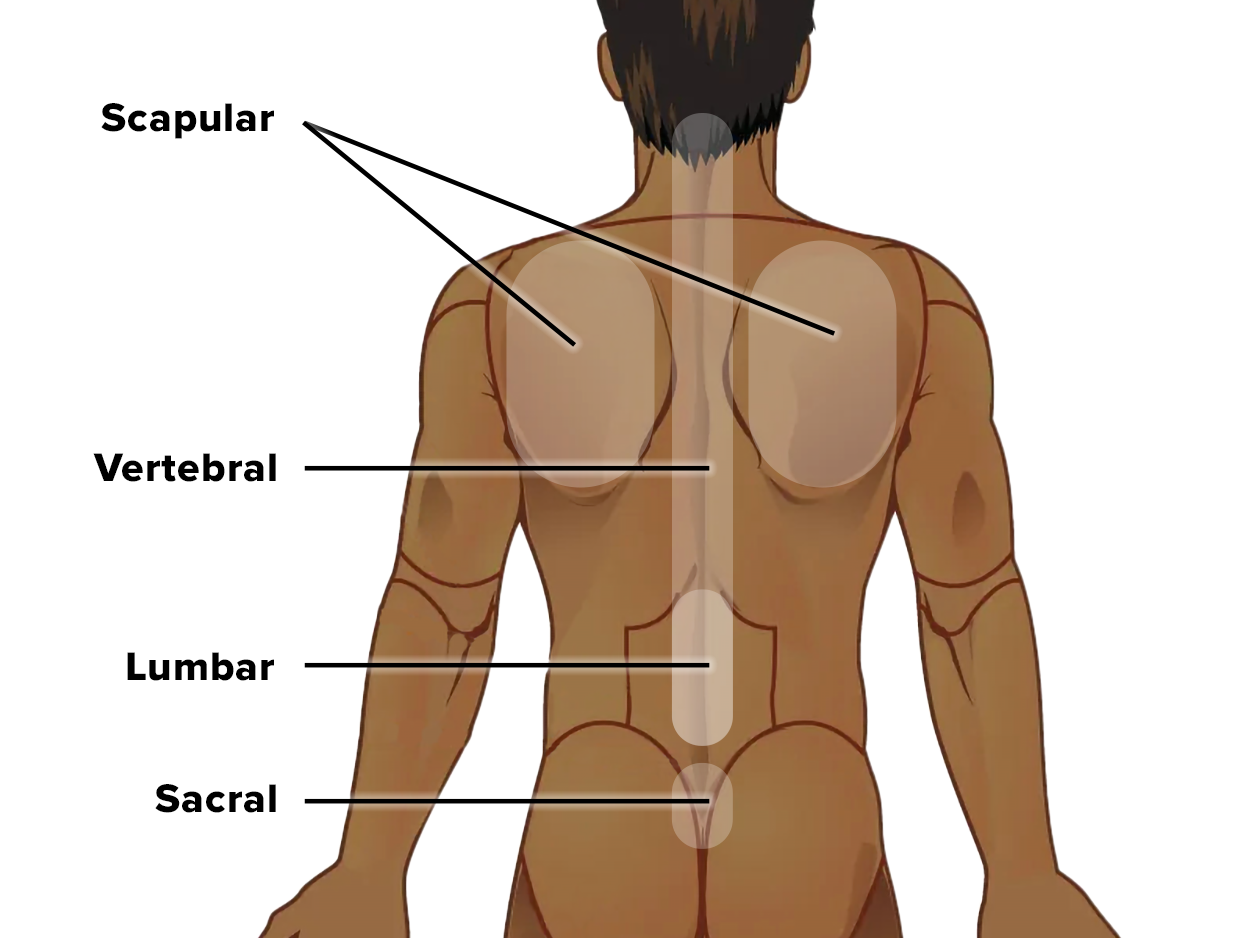 Diagram of the human back with labeled anatomical regions: Scapular (shoulder blade area), Vertebral (spinal column), Lumbar (lower back), and Sacral (area above the tailbone).