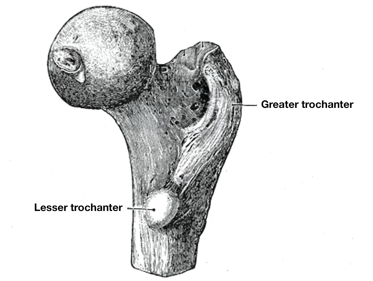 Illustration of the proximal (upper) end of the right femur. It has a rounded articular surface above a narrowed region that extends a short distance to the lower right, where there is a lateral protrusion labeled as the greater trochanter. Below, a small, rounded protrusion toward the viewer is labeled as lesser trochanter.