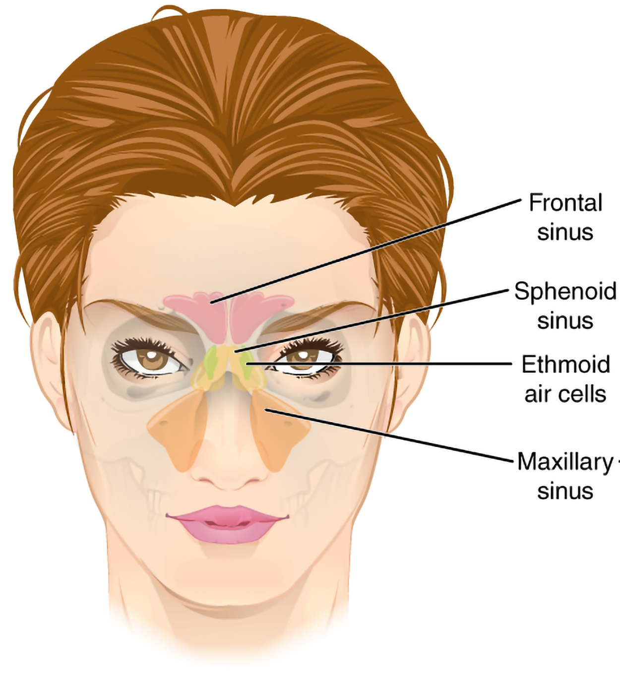 An anterior view of a woman’s face shows the four paranasal sinus regions. A label at the lower forehead points to the frontal sinus. A second label that angles inward from the side of the nose marks the sphenoid sinus, which lies deeper behind the nasal cavity. A third label, extending to the area between the eyes, identifies the ethmoid air cells. A final label directed toward the cheek area designates the maxillary sinus.