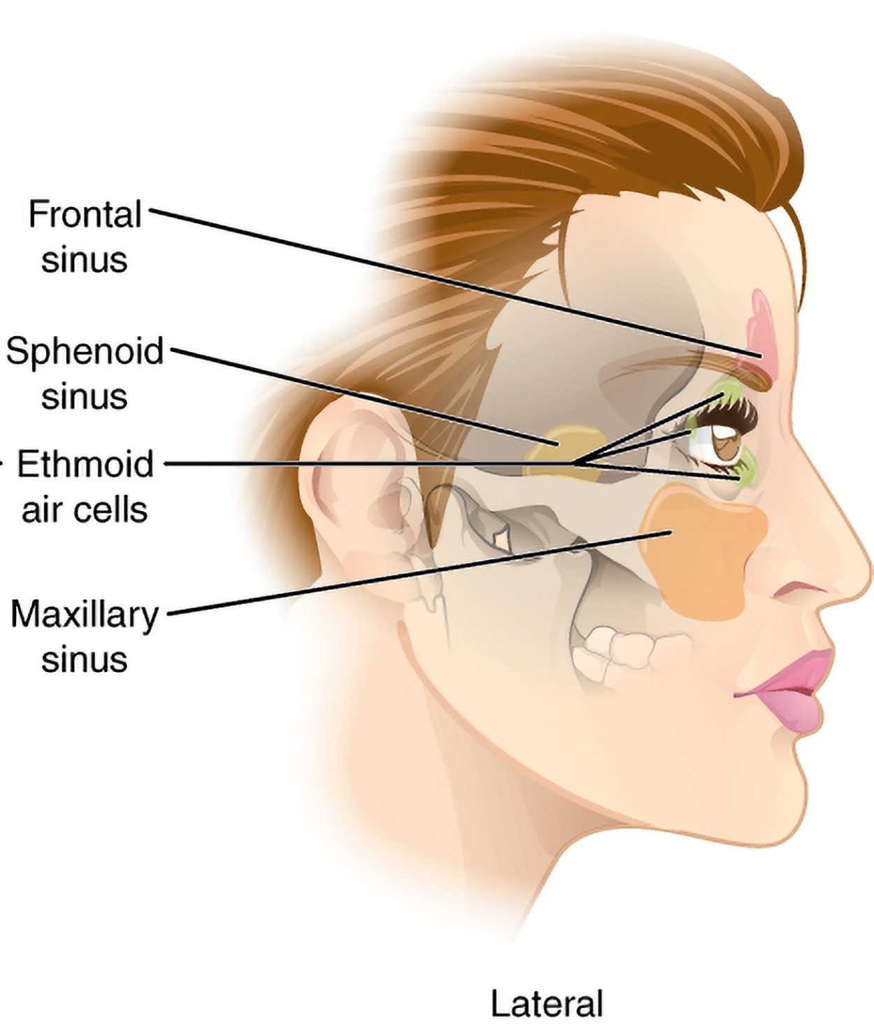 A lateral (side) view of a woman’s head shows the four paranasal sinus regions. A label at the lower forehead points to the frontal sinus above the eye. A second label angles toward a space deep behind the nasal cavity to identify the sphenoid sinus. A third label extends to a cluster of small cavities between the eye and nose, marking the ethmoid air cells. A final label directed toward the cheek area, below the eye, designates the maxillary sinus.