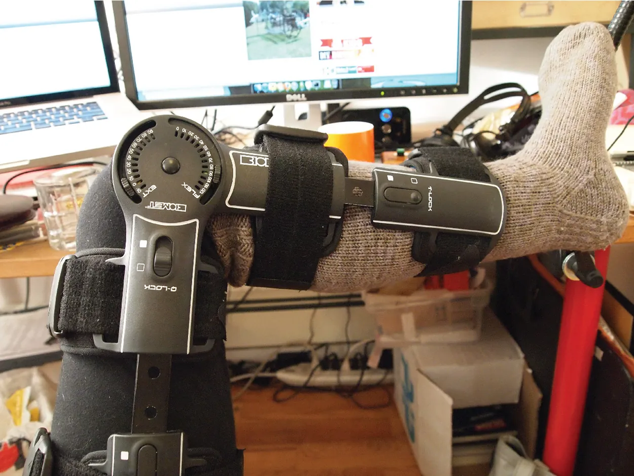  Metal device supporting bones around the knee and leg