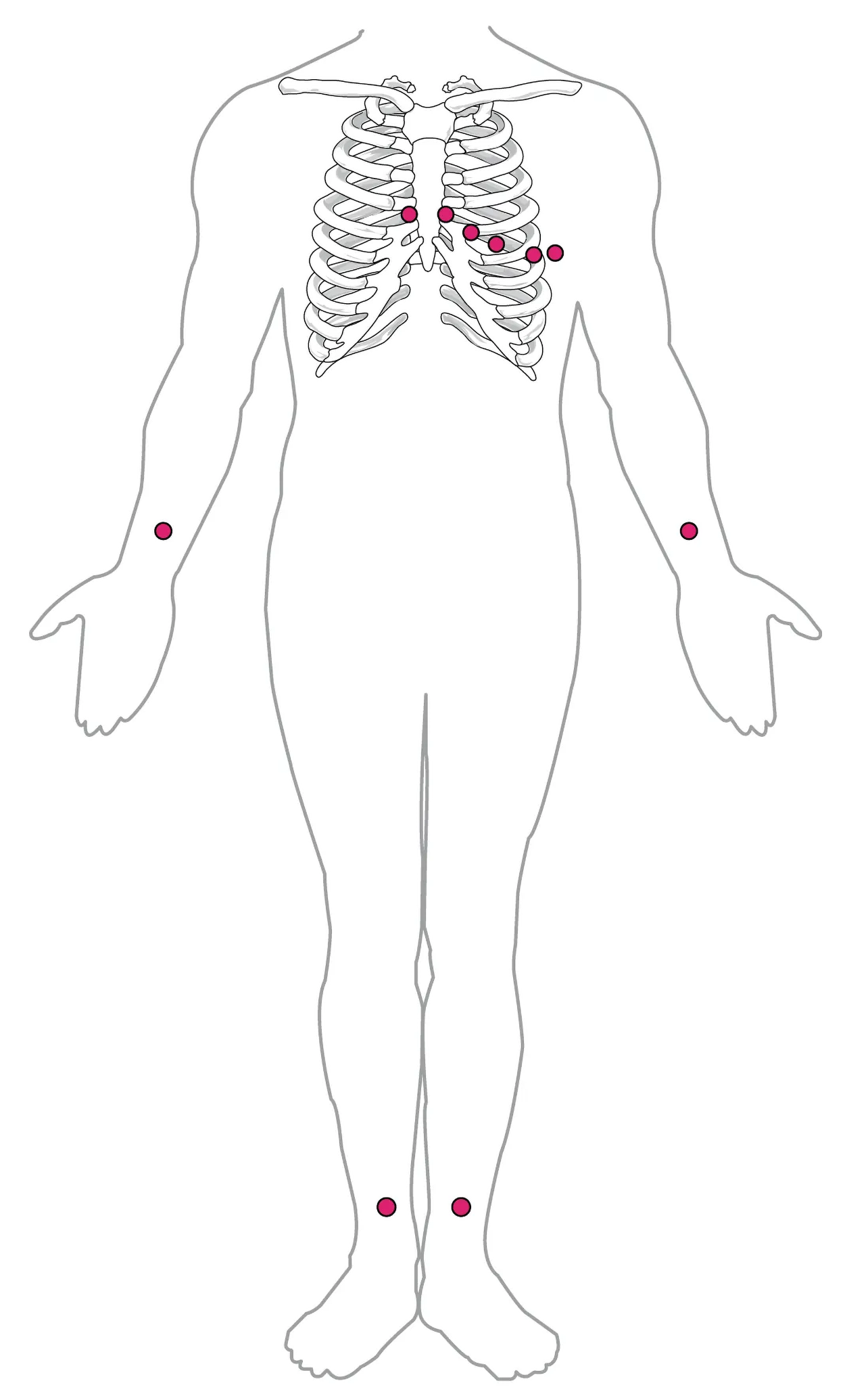 An anterior silhouette of a person shows placement positions for 10 electrodes.