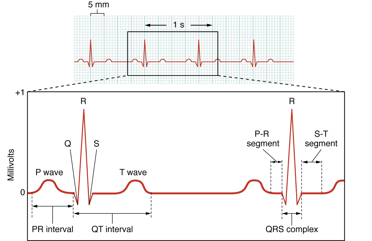 An electrocardiograph plots millivolts on the vertical axis against time. A curve begins at 0 mv, rises to form a small curve, and decreases back to 0 to form the PR interval. The curve drops a little, suddenly, to Q, rises to a high peak at R, and drops to an equivalent point to Q, which is labeled as S. The curve rises rapidly to 0 and runs horizontally for a short while, then rises to form a small curve labeled T wave. The region from Q to the end of the T wave is the QT interval. The pattern repeats, showing that the horizontal region after the P peak to the place immediately before Q is the PR segment, the region from the end of the PR segment to the horizontal after S is the QRS complex, and the region from the end of the QRS complex to just before the T peak is the S-T segment.
