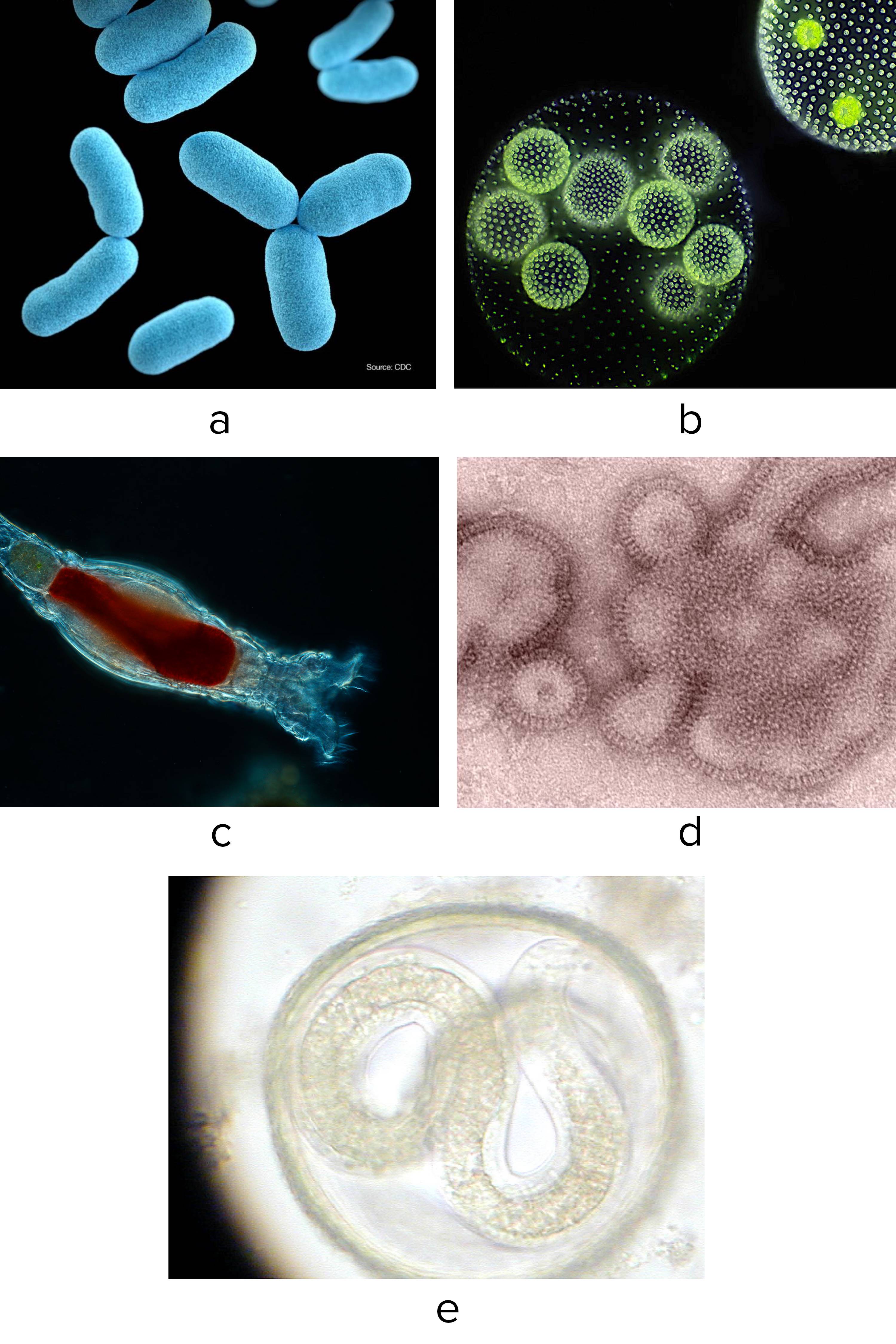Photo (a) shows a colored scanning electron micrograph of blue rod-shaped bacteria. Photo (b) is a micrograph of <i>Volvox</i>, which has many colonial cells that form a sphere with varying numbers of smaller spheres inside. Photo (c) is a micrograph of a rotifer, which is a mostly translucent microscopic animal that has an oval body tapering on one side and has a head with protrusions on each side. The darker shapes of organs are visible in its oval body. Photo (d) is a scanning electron micrograph of irregular rounded shapes of influenza viruses. Photo (e) shows a translucent roundworm in human tissue.