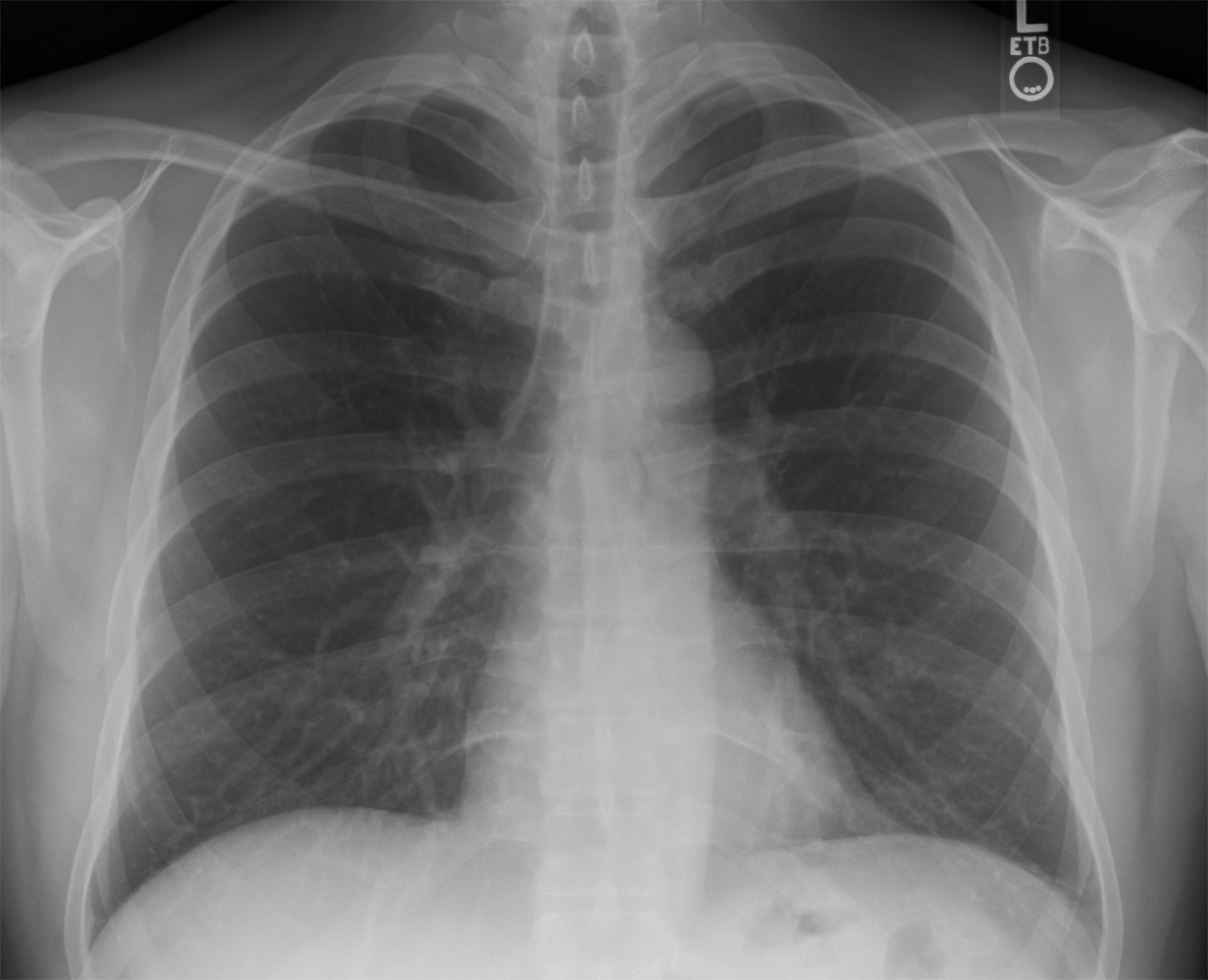 Respiratory Diagnostic, Surgical, and Therapeutic Procedures Tutorial ...