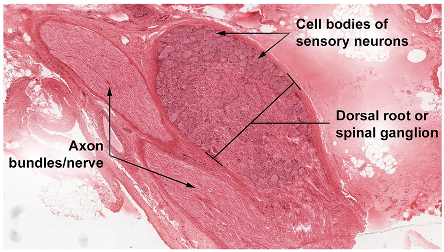 A micrograph shows many cell bodies of sensory neurons in a dorsal root or spinal ganglion. Nearby, there are two narrower axon bundles/nerves.