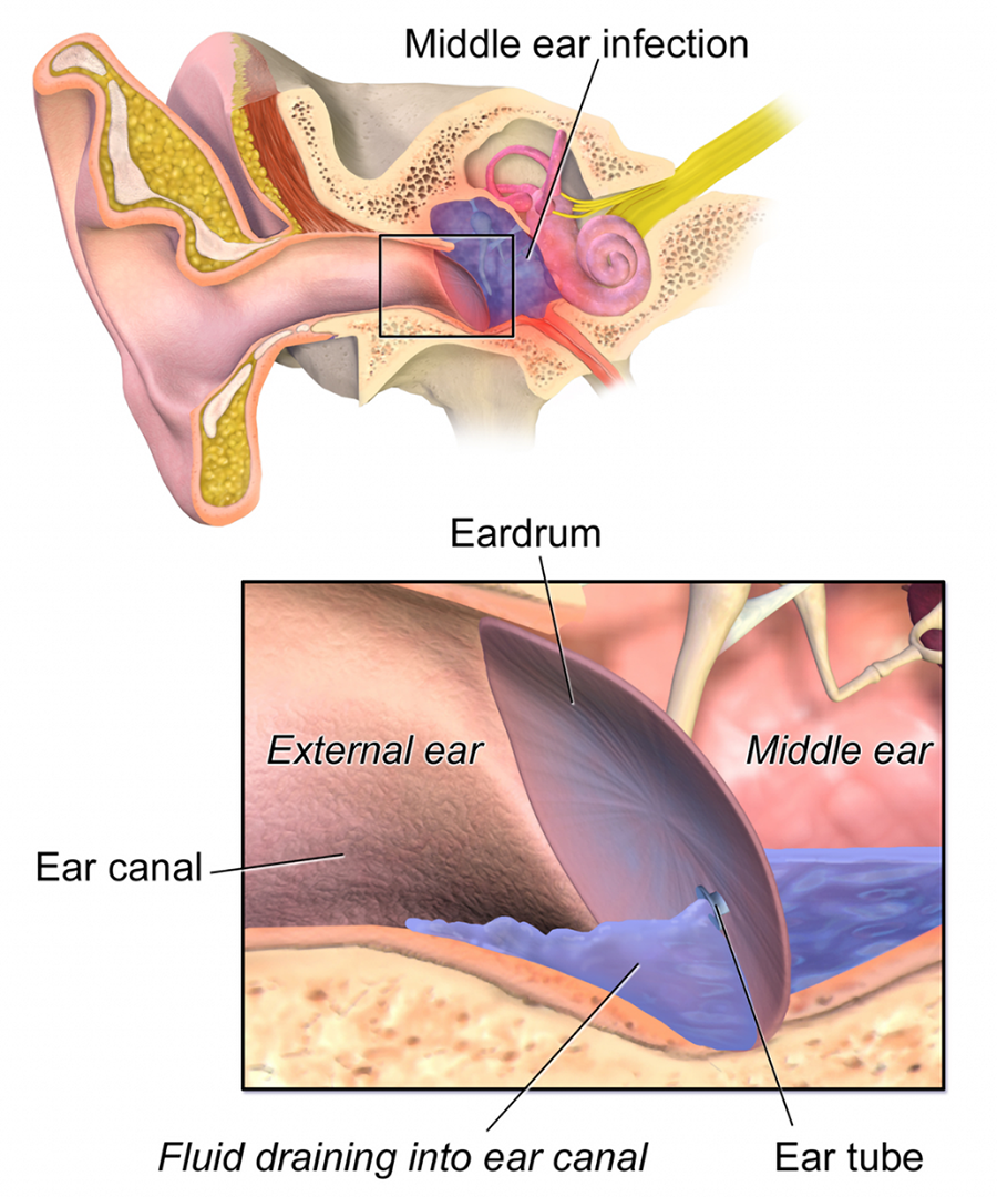 Ear and Eye Diagnostic, Surgical, and Therapeutic Procedures Tutorial ...