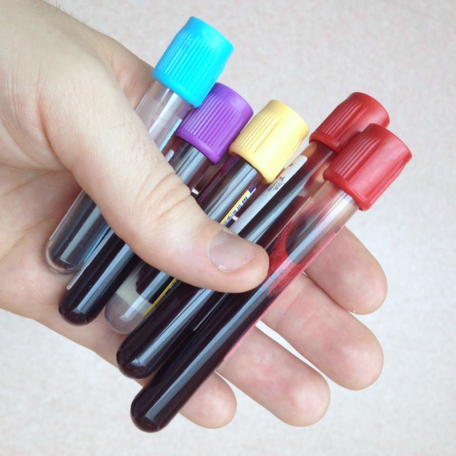 A photo of a hand holding five clear tubes containing blood. The tubes differ in size and each has a different color of rubber stopper.